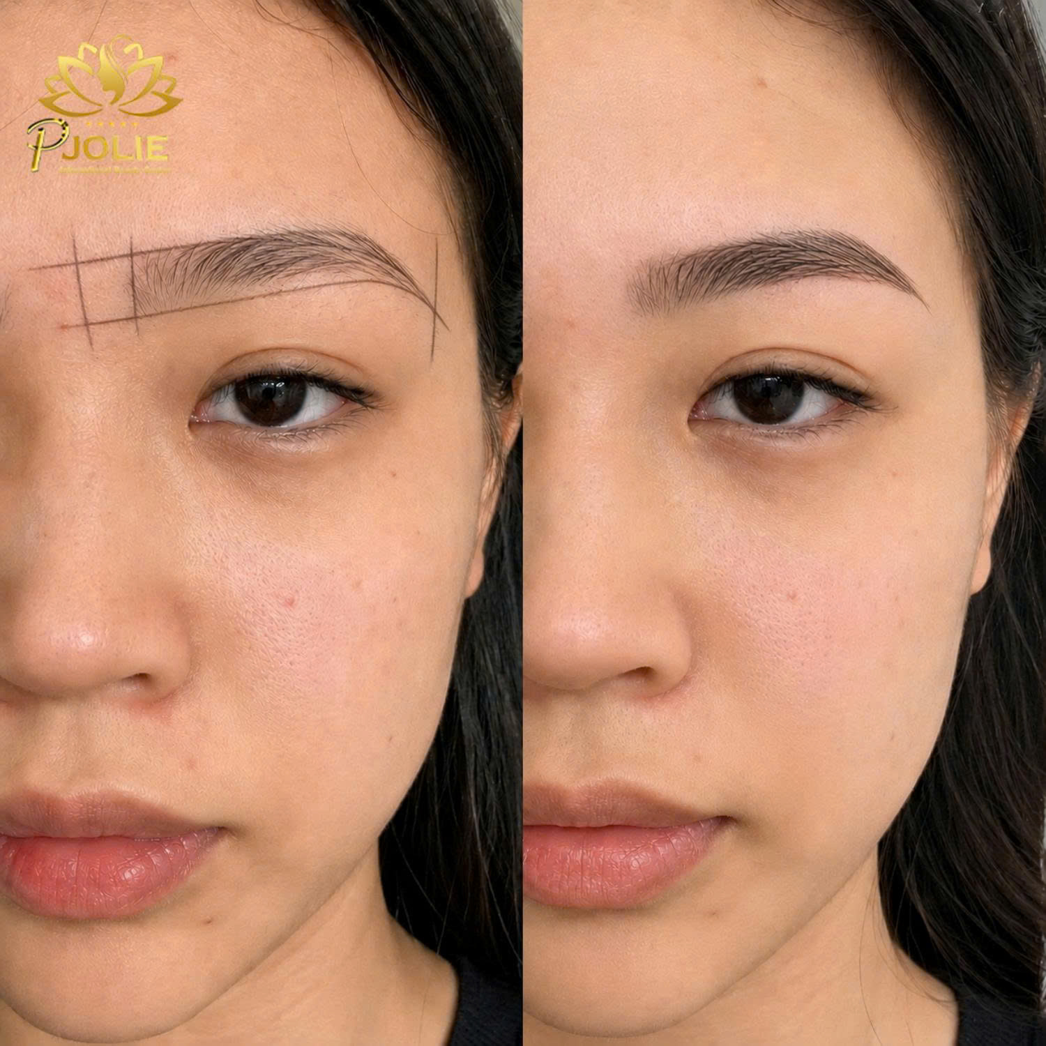PJOLIE Cambodia before and after eyebrow result 1