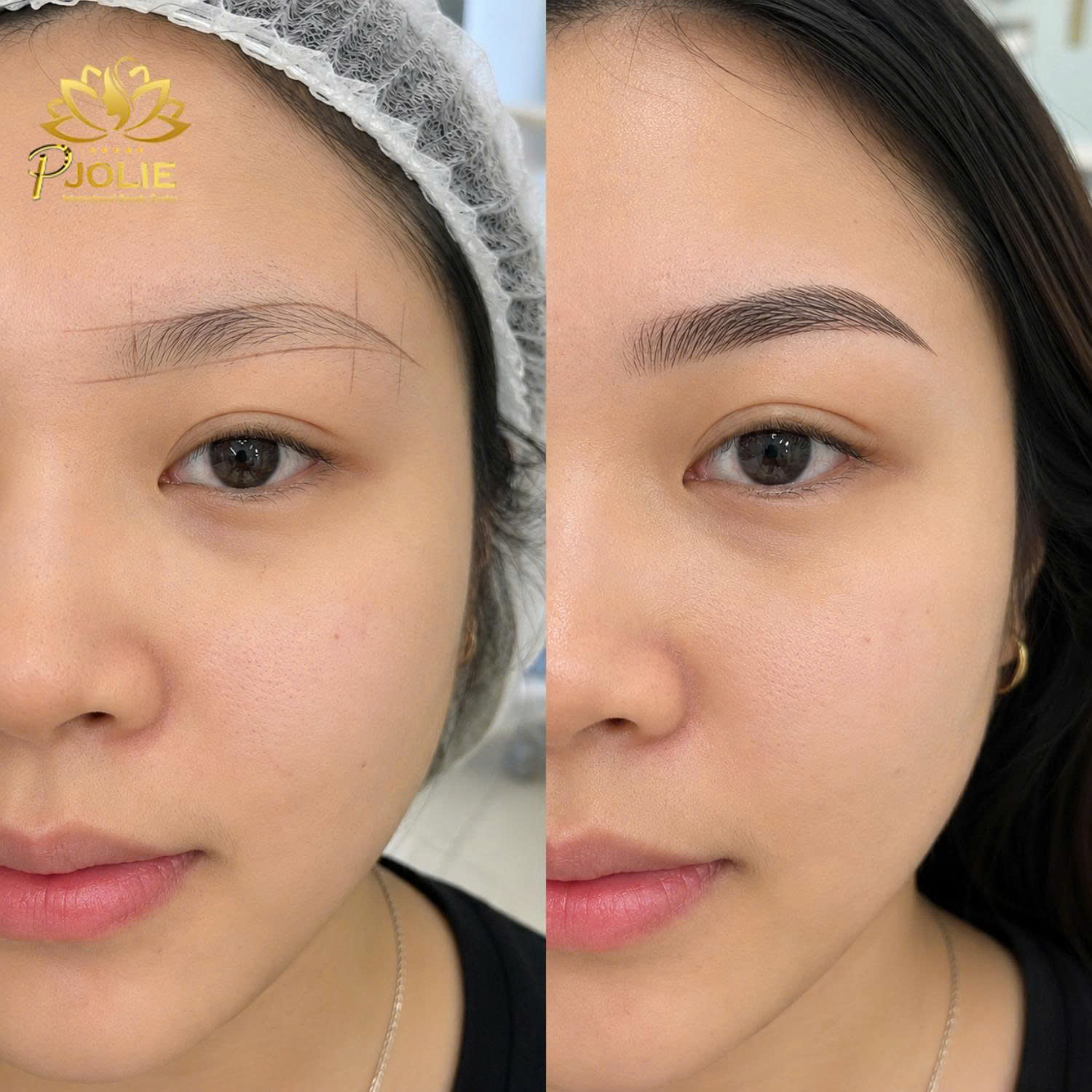 PJOLIE Cambodia before and after eyebrow result 4